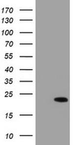 C17orf37 Antibody in Western Blot (WB)