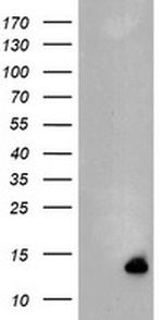 C17orf37 Antibody in Western Blot (WB)