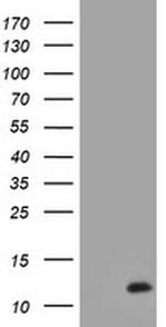 C17orf37 Antibody in Western Blot (WB)