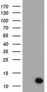 C17orf37 Antibody in Western Blot (WB)