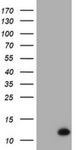 C17orf37 Antibody in Western Blot (WB)