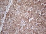 C19ORF80 Antibody in Immunohistochemistry (Paraffin) (IHC (P))