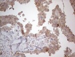 C19ORF80 Antibody in Immunohistochemistry (Paraffin) (IHC (P))