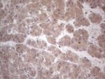 C19ORF80 Antibody in Immunohistochemistry (Paraffin) (IHC (P))