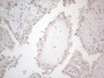 C19ORF80 Antibody in Immunohistochemistry (Paraffin) (IHC (P))