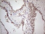 C19ORF80 Antibody in Immunohistochemistry (Paraffin) (IHC (P))