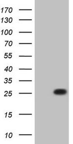 C19ORF80 Antibody in Western Blot (WB)