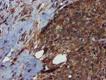 C1S Antibody in Immunohistochemistry (Paraffin) (IHC (P))