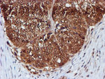 C1orf50 Antibody in Immunohistochemistry (Paraffin) (IHC (P))