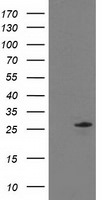 C1orf50 Antibody in Western Blot (WB)