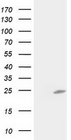 C1orf50 Antibody in Western Blot (WB)