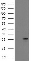 C1orf50 Antibody in Western Blot (WB)