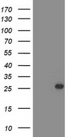 C1orf50 Antibody in Western Blot (WB)