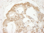 C1orf55 Antibody in Immunohistochemistry (IHC)