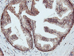 C20orf3 Antibody in Immunohistochemistry (Paraffin) (IHC (P))