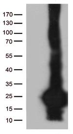 C20orf79 Antibody in Western Blot (WB)