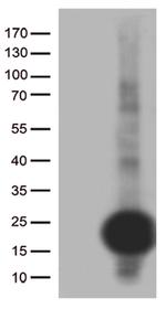 C20orf79 Antibody in Western Blot (WB)