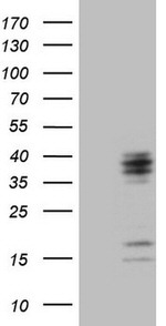 C21orf62 Antibody in Western Blot (WB)