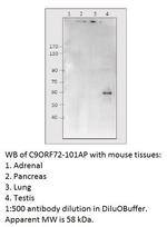 C9orf72 Antibody in Western Blot (WB)