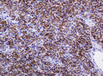 CA12 Antibody in Immunohistochemistry (Paraffin) (IHC (P))