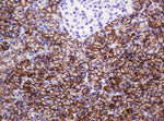 CA12 Antibody in Immunohistochemistry (Paraffin) (IHC (P))