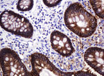 CA12 Antibody in Immunohistochemistry (Paraffin) (IHC (P))