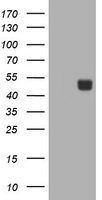 CA12 Antibody in Western Blot (WB)