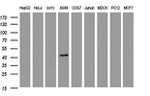 CA12 Antibody in Western Blot (WB)