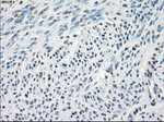 CA9 Antibody in Immunohistochemistry (Paraffin) (IHC (P))