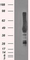 CA9 Antibody in Western Blot (WB)