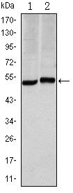 Carbonic Anhydrase IX Antibody in Western Blot (WB)