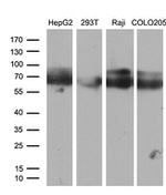 CACNB1 Antibody in Western Blot (WB)