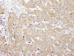 CAD Antibody in Immunohistochemistry (IHC)