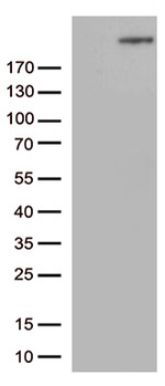 CAD Antibody in Western Blot (WB)