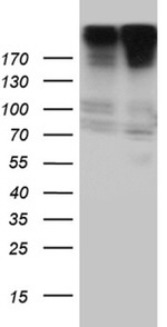 CAD Antibody in Western Blot (WB)