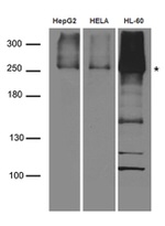 CAD Antibody in Western Blot (WB)