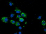 CALCOCO2 Antibody in Immunocytochemistry (ICC/IF)