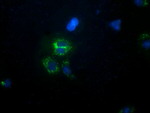 CALCOCO2 Antibody in Immunocytochemistry (ICC/IF)