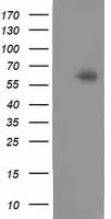 CALCOCO2 Antibody in Western Blot (WB)