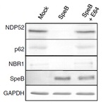 CALCOCO2 Antibody in Western Blot (WB)