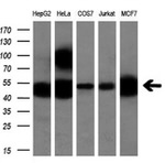 CALCOCO2 Antibody in Western Blot (WB)