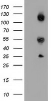 CALCOCO2 Antibody in Western Blot (WB)