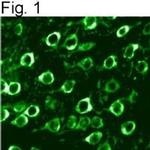 Calreticulin Antibody in Immunohistochemistry (IHC)