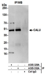 CALU Antibody in Immunoprecipitation (IP)