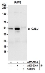 CALU Antibody in Immunoprecipitation (IP)