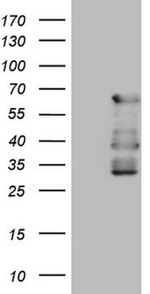 CAMK2B Antibody in Western Blot (WB)