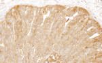 CAP1 Antibody in Immunohistochemistry (IHC)