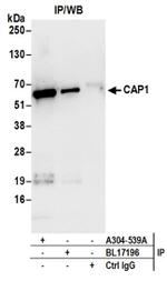 CAP1 Antibody in Western Blot (WB)