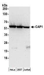 CAP1 Antibody in Western Blot (WB)