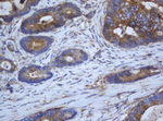 CAPN2 Antibody in Immunohistochemistry (Paraffin) (IHC (P))